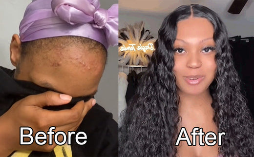No Glue Needed-Sensitive Scalp Friendly